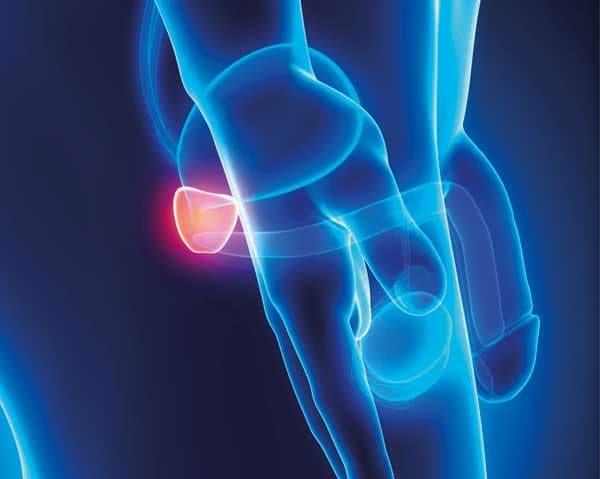 Saúde Prostática - Dr. Murilo Murata